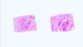 Paraffin Tissue Section - Human Adult Normal: Brain: Postcentral Gyrus